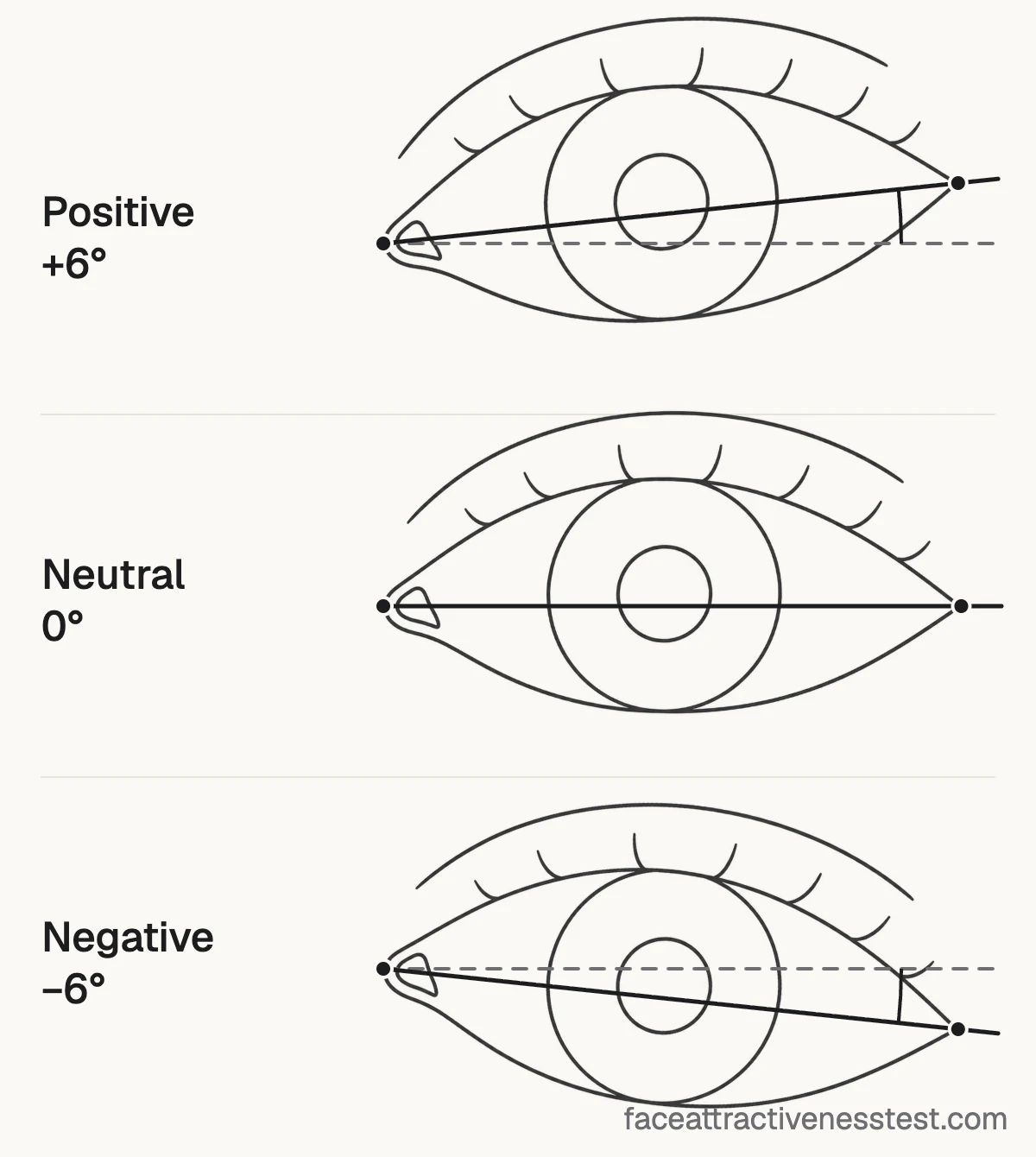 Line drawing comparing positive, neutral and negative canthal tilt: the outer eye corner sits higher than, level with, or lower than the inner corner.